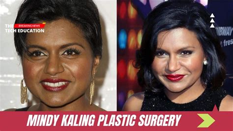 mindy kaling plastic surgery|Mindy Kaling, Before and After